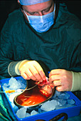 Surgeon perfusing donor kidney for transplantation