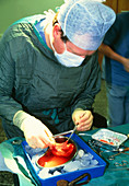 Surgeon preparing donor kidney for transplantation
