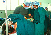 Surgeons performing a kidney transplant operation