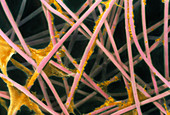 Coloured SEM of artificially-grown cartilage