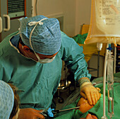 Surgeon conducts liposuction for breast reduction