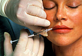 Injection to increase the volume of a woman's lip