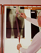 Professor Scales: designer of prostheses