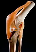 Artificial knee joint