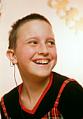 Young deaf girl wearing a cochlear implant device