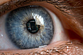 Eye implant restoring sight