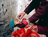 Polio vaccination,India