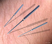 Acupuncture needles