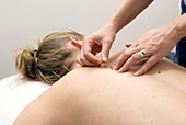 Acupuncture treatment