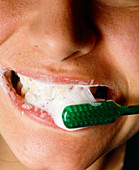 Cleaning of teeth