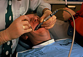 Dentist drills the tooth of male patient