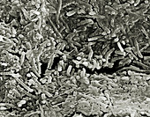 SEM of dental plaque showing bacterial content