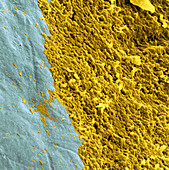 Coloured SEM of a dental plaque seen on a tooth