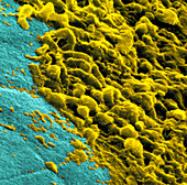 Coloured SEM of dental plaque seen on a tooth
