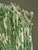 Dental plaque,SEM