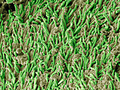 Dental plaque,SEM