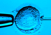 In vitro fertilisation: egg injected with sperm