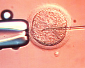 ICSI technique: egg injected with sperm