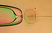 IVF: egg being injected with sperm DNA