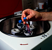 Test tube of sperm being placed in a centrifuge