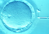 ICSI method of in vitro fertilization