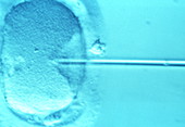 ICSI method of in vitro fertilization