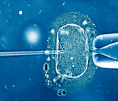 In vitro fertilization,light microscope