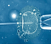 In vitro fertilization,light microscope