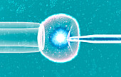 In vitro fertilization