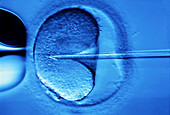 In vitro fertilisation