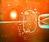 IVF treatment,light micrograph
