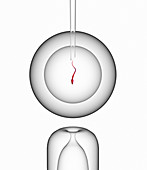 IVF,conceptual computer artwork