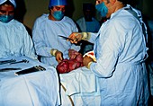 Caesarean birth: preparing to cut umbilical cord