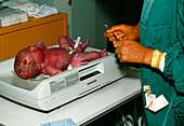 View of a caesarean baby being weighed