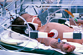 Infant receives intensive care