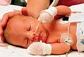 Baby in hospital intensive care unit