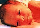View of the face of a premature baby
