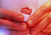 Hands holding the foot of a premature baby