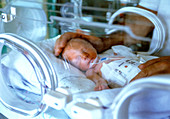 Premature baby