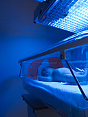 Neonatal jaundice light treatment
