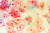 Cervical smear mid-cycle