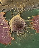 Cervical cancer cell,SEM