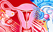 Art of female contraceptives: diaphragm,IUD,pill