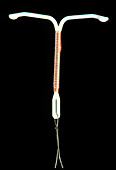 Close-up of an intrauterine contraceptive device
