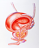 Illustration showing inflamed prostate gland