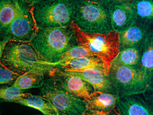 Immunofluorescent LM of prostate cancer cells