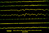 Sleep research: various traces of subject awake