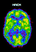 Coloured PET scan of human brain during NREM sleep