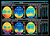 EEG brain image during mobile phone research