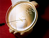 Petri dish culture of bacterium Escherichia coli